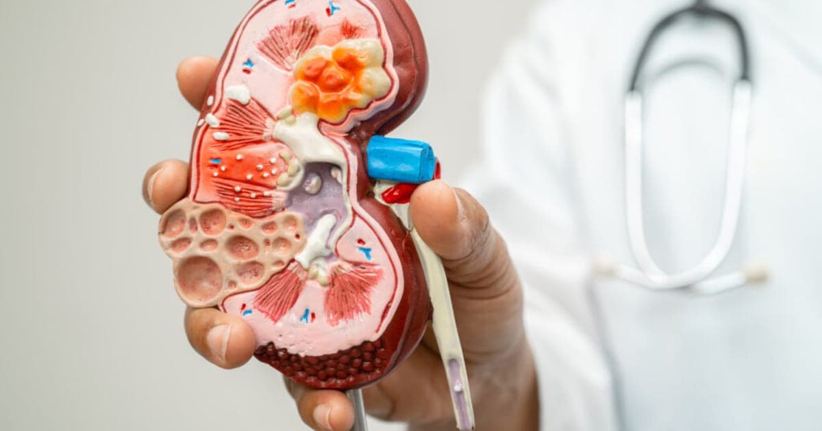 Investigación revela conexión entre falla renal y cardíaca